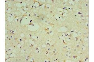 Immunohistochemistry of paraffin-embedded human brain tissue using ABIN7149475 at dilution of 1:100 (DRD3 antibody  (AA 213-329))