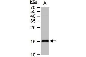 WB Image LC3B antibody detects LC3B protein by western blot analysis. (LC3B antibody)