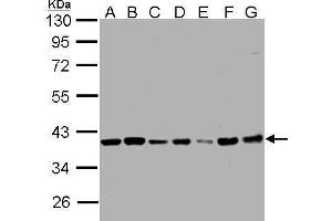 WB Image Sample (30μg whole cell lysate) A: 293T B: A431 , C: H1299 D: HeLa S3 , E: Hep G2 , F: MOLT4 , G: Raji , 7. (PPP1CB antibody  (Center))