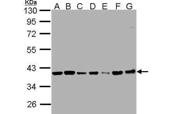 PPP1CB antibody  (Center)