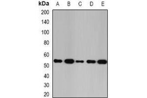 Western blot analysis of Glutathione Synthetase expression in SW480 (A), K562 (B), Raji (C), mouse kidney (D), mouse liver (E) whole cell lysates. (Glutathione Synthetase antibody)