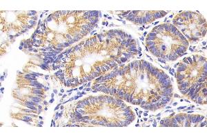 Immunohistochemistry (IHC) image for anti-Cytochrome C Oxidase Subunit II (COX2) (AA 83-227) antibody (ABIN7445771)