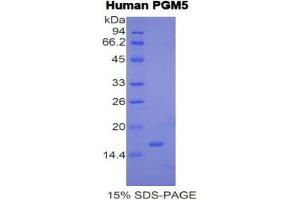 SDS-PAGE analysis of Human Phosphoglucomutase 5 Protein. (Phosphoglucomutase 5 Protein (PGM5))
