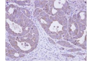 TCP1 epsilon Antibody staining of paraffin-embedded NCIN87 xenograft at 1/500 dilution. (CCT5 antibody  (AA 1-224))