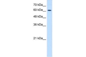 Western Blotting (WB) image for anti-Cholinergic Receptor, Nicotinic, epsilon (Muscle) (CHRNE) antibody (ABIN2463737) (CHRNE antibody)