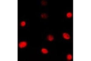 Immunofluorescent analysis of TBX1 staining in Jurkat cells. (T-Box 1 antibody  (C-Term))