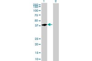 Western Blot analysis of BCL7C expression in transfected 293T cell line by BCL7C MaxPab polyclonal antibody. (BCL7C antibody  (AA 1-217))