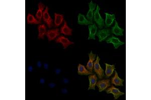 ABIN6255593 and ABIN6267543 staining HepG2 cells(30 min of 4uM Forskolin treatment) by IF/ICC. (Tuberin antibody  (pThr1462))