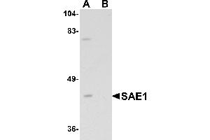Western blot analysis of SAE1 in SK-N-SH lysate with SAE1 antibody at 1 µg/mL in (A) the absence and (B) the presence of blocking peptide.