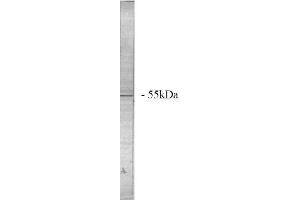 Image no. 1 for anti-Protein Phosphatase 2, Regulatory Subunit A, beta (PPP2R1B) (N-Term) antibody (ABIN264941) (PPP2R1B antibody  (N-Term))