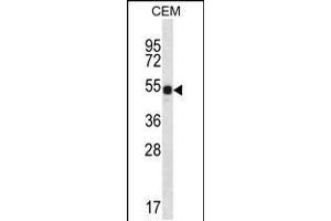 Western blot analysis in CEM cell line lysates (35ug/lane). (DAZ3 antibody  (C-Term))