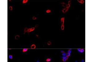 Immunofluorescence analysis of NIH/3T3 cells using ATP5B Polyclonal Antibody at dilution of 1:100 (40x lens). (ATP5B antibody)