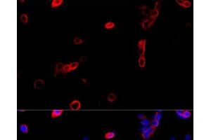 Immunofluorescence analysis of NIH/3T3 cells using ATP5B Polyclonal Antibody at dilution of 1:100 (40x lens). (ATP5B antibody)