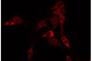 ABIN6275157 staining HeLa by IF/ICC. (GORASP2 antibody  (Internal Region))