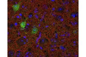Indirect immunolabeling of PFA fixed mouse cortex section with anti-SV2 B (dilution 1 : 200; red) and guinea pig anti-calbindin (cat. (SV2B antibody  (AA 2-17))