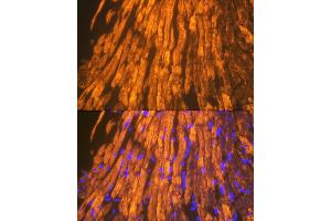 Immunofluorescence analysis of mouse heart using  Rabbit mAb (ABIN7265397) at dilution of 1:100 (40x lens). (ACTN2 antibody)