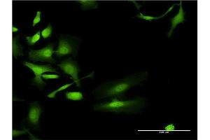 Immunofluorescence of monoclonal antibody to UGT2B4 on HeLa cell. (UGT2B4 antibody  (AA 25-124))