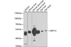 Western blot analysis of extracts of various cell lines using AMY1A Polyclonal Antibody at dilution of 1:1000. (AMY1A antibody)