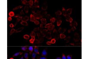 Immunofluorescence analysis of HeLa cells using KAT7 Polyclonal Antibody at dilution of 1:100 (40x lens). (MYST2 antibody)