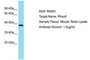 Image no. 1 for anti-Reproductive Homeobox 8 (RHOX8) (AA 180-229) antibody (ABIN6750292) (RHOX8 antibody  (AA 180-229))