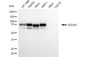 Western blotting analysis using GOLM1 antibody (ABIN7798792).