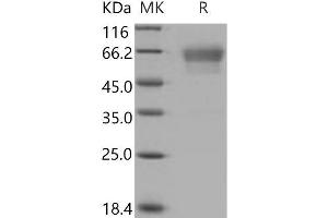 Western Blotting (WB) image for Podoplanin (PDPN) (Active) protein (His tag,Fc Tag) (ABIN7320346)