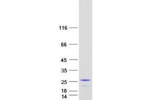 Western Blotting (WB) image for Protein Phosphatase 1, Regulatory (Inhibitor) Subunit 14D (PPP1R14D) (Transcript Variant 1) protein (Myc-DYKDDDDK Tag) (ABIN2729475)