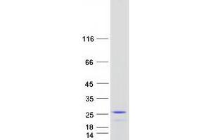 Validation with Western Blot (PPP1R14D Protein (Transcript Variant 1) (Myc-DYKDDDDK Tag))