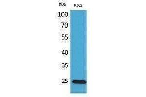 Western Blotting (WB) image for anti-Insulin-Like Growth Factor Binding Protein 6 (IGFBP6) (Internal Region) antibody (ABIN3178388) (IGFBP6 antibody  (Internal Region))