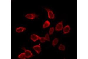 ABIN6275396 staining NIH-3T3 by IF/ICC. (Prosaposin antibody  (Internal Region))