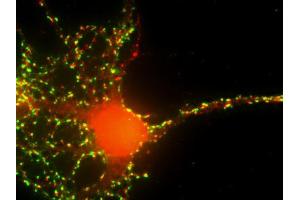 Immunofluorescence labeling of a cultured hippocampal neuron with anti-synaptopodin (red; dilution 1 : 600) and anti-synaptophysin (green; ; dilution 1 : 200). (SYNPO antibody  (Center))