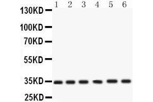 Western Blotting (WB) image for anti-Cyclin-Dependent Kinase 4 (CDK4) (AA 201-303) antibody (ABIN3043745) (CDK4 antibody  (AA 201-303))