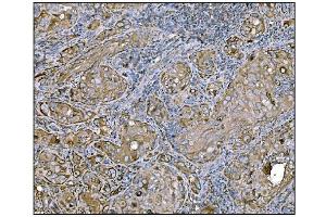 IHC analysis of HCCS using anti-HCCS antibody (ABIN7602424). (HCCS antibody  (AA 76-268))