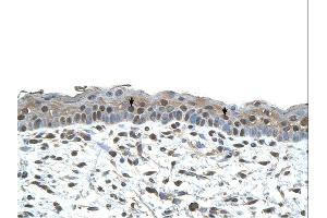 Immunohistochemistry (IHC) image for anti-Centromere Protein A (CENPA) (N-Term) antibody (ABIN2782448) (CENPA antibody  (N-Term))