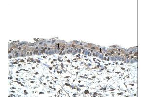 Immunohistochemistry (IHC) image for anti-Centromere Protein A (CENPA) (N-Term) antibody (ABIN310757) (CENPA antibody  (N-Term))