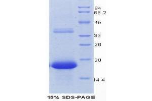 SDS-PAGE (SDS) image for Regenerating Islet Derived Protein 3 gamma (REG3g) (AA 45-152) protein (His tag) (ABIN1080619) (REG3g Protein (AA 45-152) (His tag))