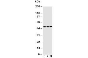 Western Blotting (WB) image for anti-Chemokine (C-X-C Motif) Receptor 4 (CXCR4) (AA 31-43) antibody (ABIN3030515)