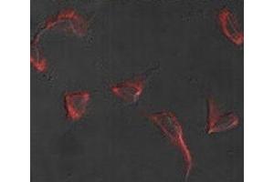 Immunofluorescence analysis of Nestin antibody and HeLa cells. (Nestin antibody  (AA 1560-1590))