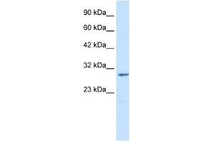 CLIC2 antibody used at 1. (CLIC2 antibody  (Middle Region))