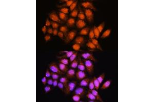 Immunofluorescence analysis of HeLa cells using ADK Rabbit pAb (ABIN7265463) at dilution of 1:100. (ADK antibody  (AA 200-345))