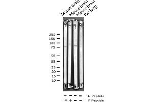 anti-Forkhead Box O1/3/4 (FOXO1/3/4) (pThr24), (pThr32) antibody