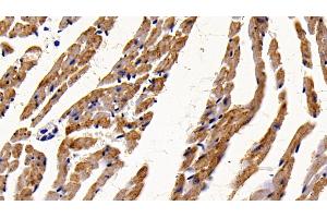 Immunohistochemistry (IHC) image for anti-Hexosaminidase B (Beta Polypeptide) (HEXB) (AA 315-456) antibody (ABIN7432289)