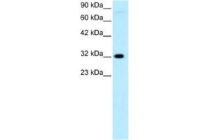 WB Suggested Anti-MEOX1 Antibody Titration:  0. (MEOX1 antibody  (N-Term))