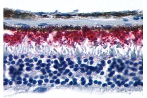 Anti-RHO / Rhodopsin antibody IHC of human eye, retina. (Rhodopsin antibody  (Extracellular Domain))