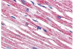 Immunohistochemistry (Paraffin-embedded Sections) (IHC (p)) image for anti-Tubulin, beta (TUBB) antibody (ABIN93914)