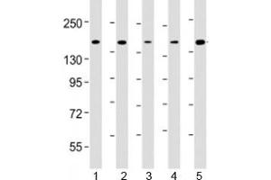 Western blot testing of human 1) K562, 2) Jurkat, 3) HeLa, 4) rat C6 and 5) human MOLT-4 cell lysate with CTCF antibody at 1:4000. (CTCF antibody  (AA 445-727))