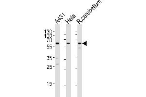 Western blot analysis of lysates from A431, Hela cell line and rat cerebellum tissue lysare(from left to right), using KISS1R Antibody (Center) (ABIN1881480 and ABIN2843217). (KISS1R antibody  (AA 235-263))