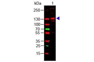 Lane 1: Human Collagen III. (COL3 antibody)