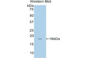Western blot analysis of the recombinant protein. (CYP1B1 antibody  (AA 374-516))