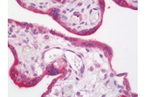 Human Placenta: Formalin-Fixed, Paraffin-Embedded (FFPE) (MAGEA3 antibody)